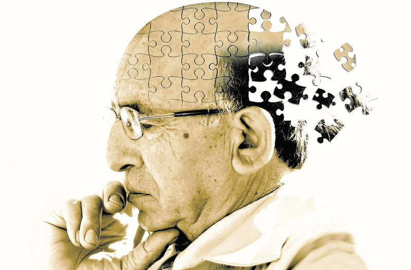 Người già chức năng não suy giảm – là đối tượng cần sử dụng sản phẩm tăng trí nhớ
