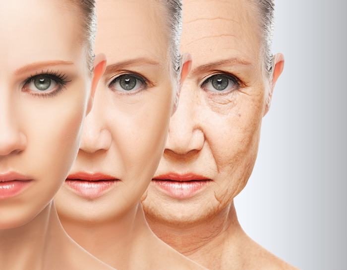 Thiếu hụt collagen khiến làn da nhăn nheo và xuất hiện các dấu hiệu lão hóa