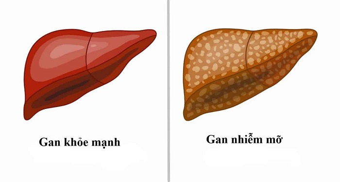 Dầu cá omega 3 của Úc có tác dụng gì