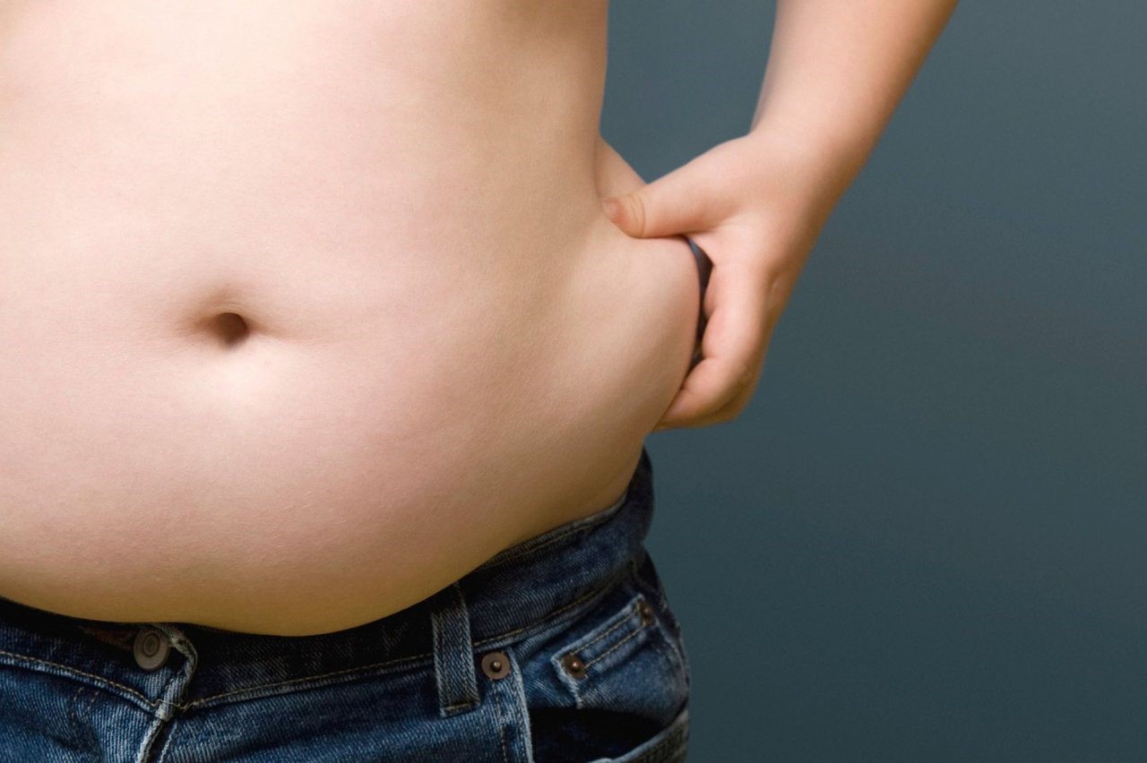 Nam giới suy giảm nội tiết tố nam có biểu hiện tích tụ mỡ thừa, béo phì, béo bụng