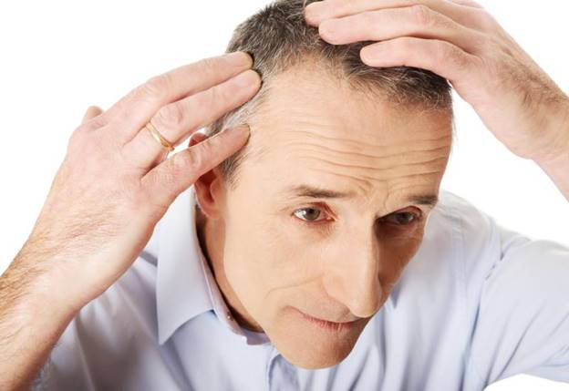 Rụng tóc là dấu hiệu phổ biến do rối loạn nội tiết tố