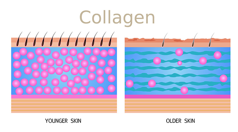 Quá trình lão hóa da sẽ mất đi khoảng 1-1.5% lượng Collagen mỗi năm