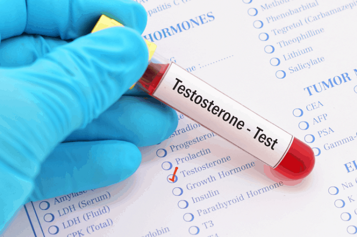 Khi nào cần làm xét nghiệm Testosterone ở nam giới